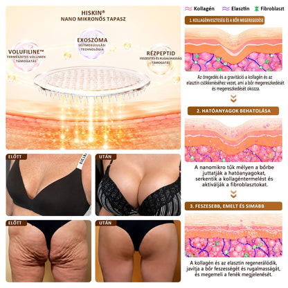 HISKIN®🏆 Mellvolumen, Emelés és Feszesítés Támogatására Szolgáló Nano Mikrotűs Tapasz Volufiline + Exosome + Rézpeptid Formula Sejtmegújító Technológiával Támogatva